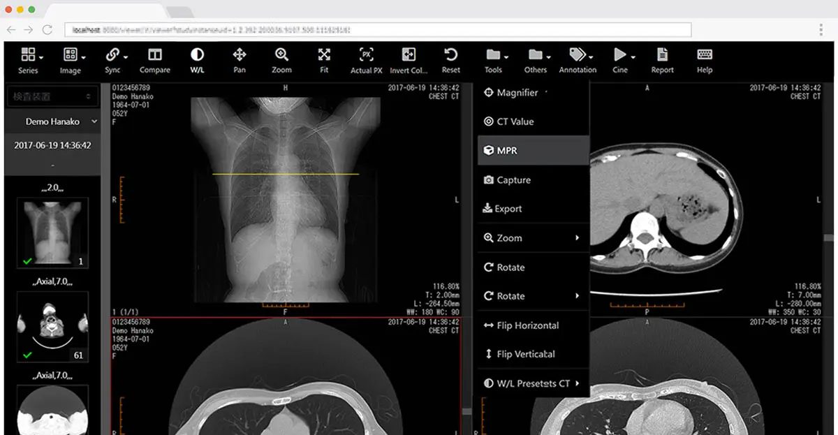Featured image for “SonicDICOM PACS released New Version 3.6.0.”