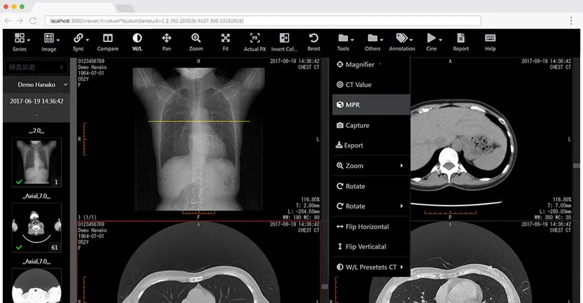 Featured image for “SonicDICOM PACS released New version 3.6.1.”