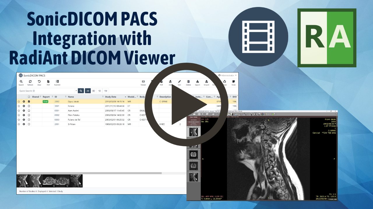 Featured image for “Integration with RadiAnt DICOM Viewer”